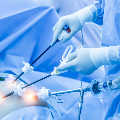 Endoscopic Surgery-1